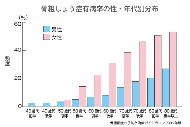 どうすれば自然に骨粗鬆症を遅らせることができるでしょうか?